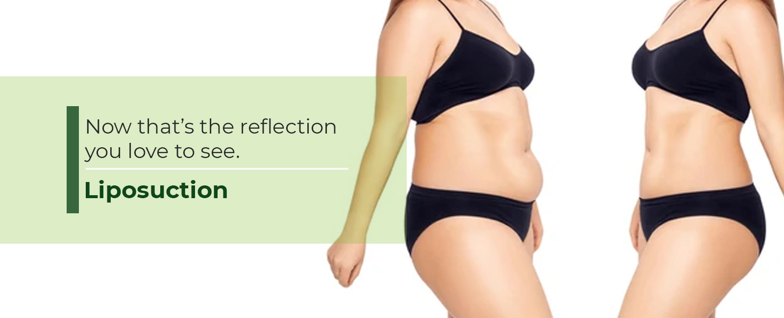 Liposuction-banner