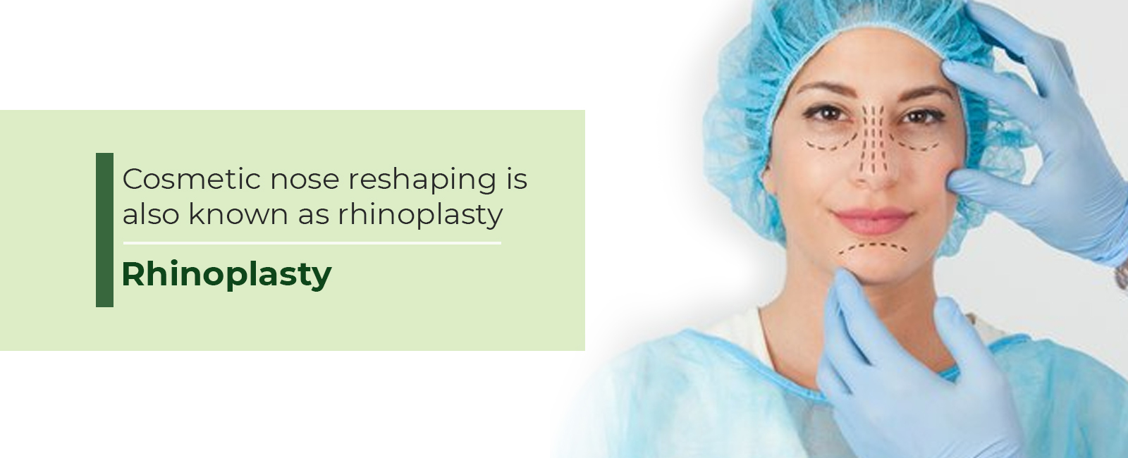 Rhinoplasty