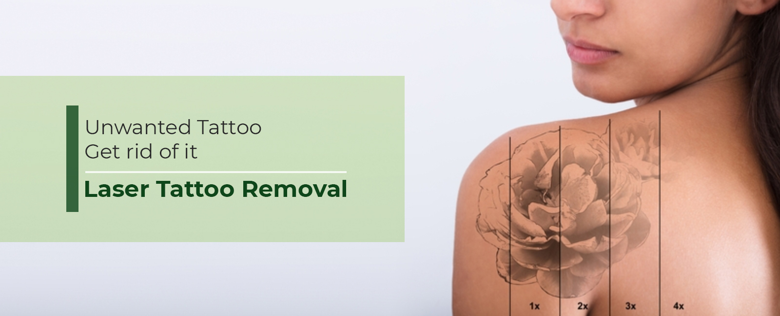 Tattoo-Removal-cover